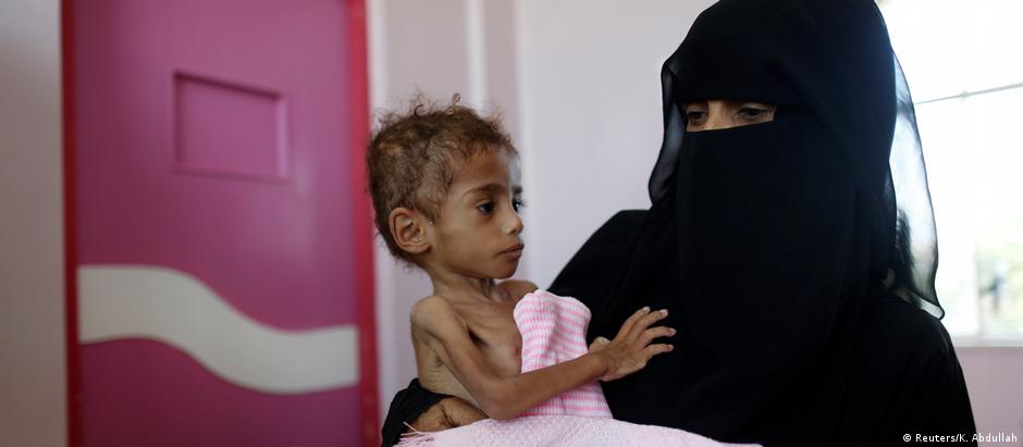 Ao menos 250 mil iemenitas estão na mais severa Fase 5 na escala global de insegurança alimentar a desnutrição